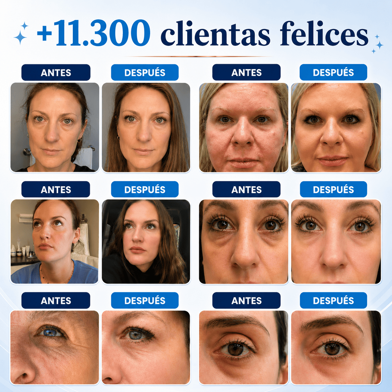 Dermolab Chile | Crema Antiedad para Rostro, Cuello y Cuerpo