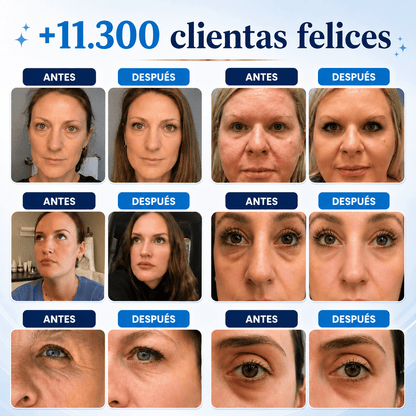 Dermolab Chile | Crema Antiedad para Rostro, Cuello y Cuerpo